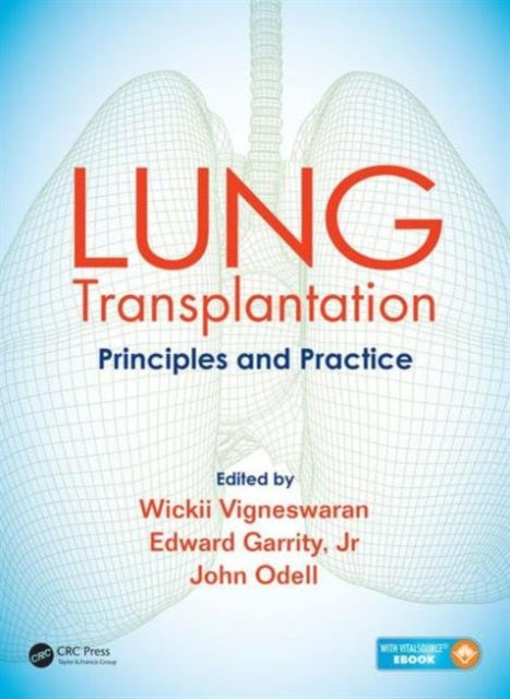 Lung Transplantation: Principles and Practice