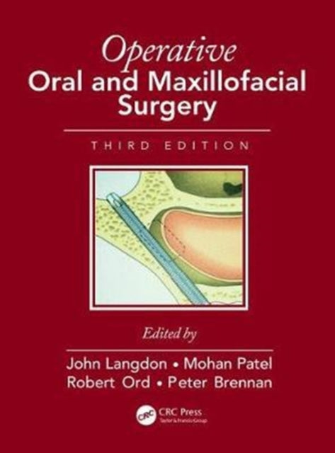 Operative Oral and Maxillofacial Surgery