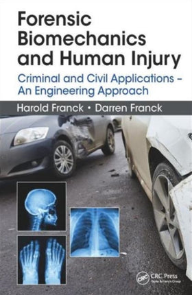 Forensic Biomechanics and Human Injury: Criminal and Civil Applications - An Engineering Approach