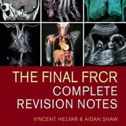 The Final FRCR