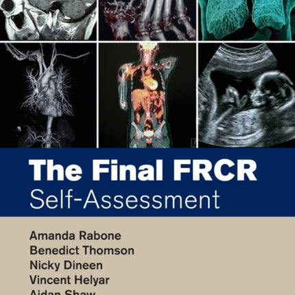 The Final FRCR