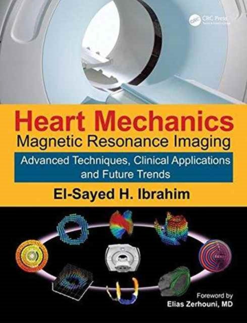 Heart Mechanics: Magnetic Resonance Imaging—Advanced Techniques, Clinical Applications, and Future Trends