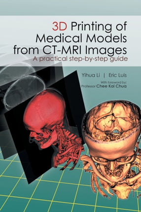 3D Printing of Medical Models from CTMRI Images A Practical stepbystep guide