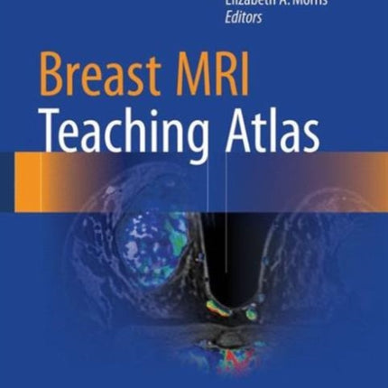 Breast MRI Teaching Atlas