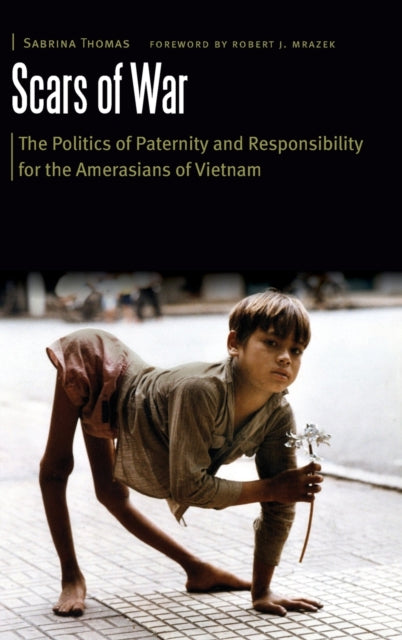 Scars of War: The Politics of Paternity and Responsibility for the Amerasians of Vietnam