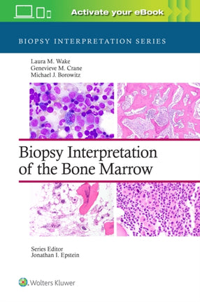 Biopsy Interpretation of the Bone Marrow