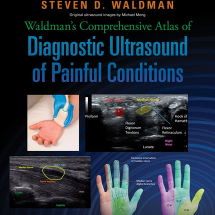 Waldman's Comprehensive Atlas of Diagnostic Ultrasound of Painful Conditions