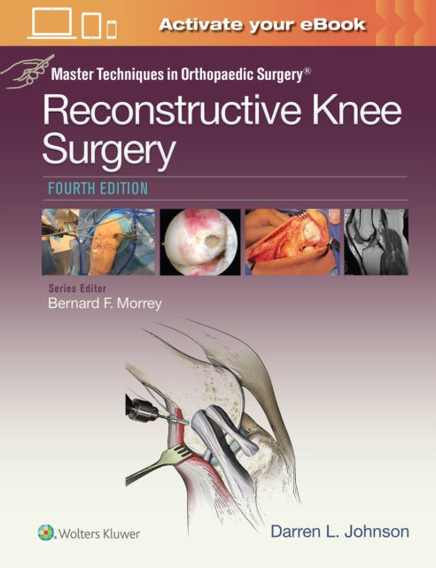 Master Techniques in Orthopaedic Surgery: Reconstructive Knee Surgery