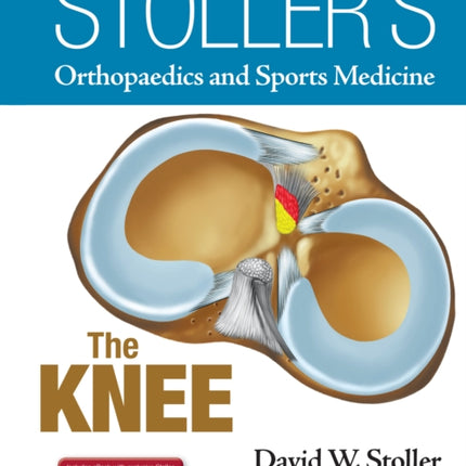 Stoller's Orthopaedics and Sports Medicine: The Knee: Includes Stoller Lecture Videos and Stoller Notes