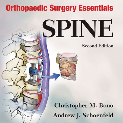 Orthopaedic Surgery Essentials: Spine