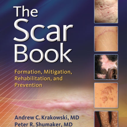 The Scar Book: Formation, Mitigation, Rehabilitation and Prevention