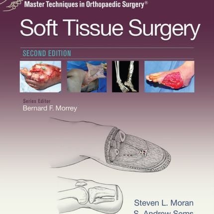 Master Techniques in Orthopaedic Surgery: Soft Tissue Surgery