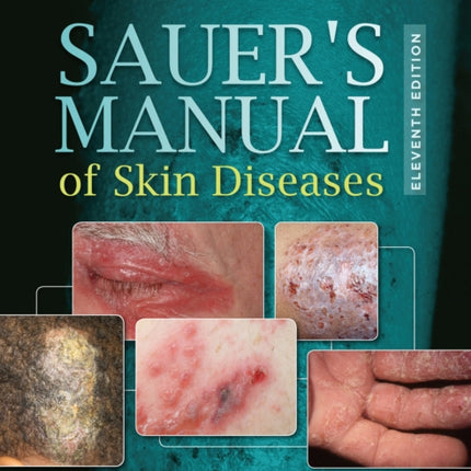 Sauer's Manual of Skin Diseases