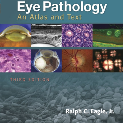 Eye Pathology: An Atlas and Text