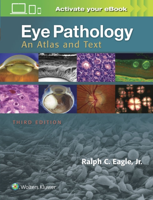 Eye Pathology: An Atlas and Text