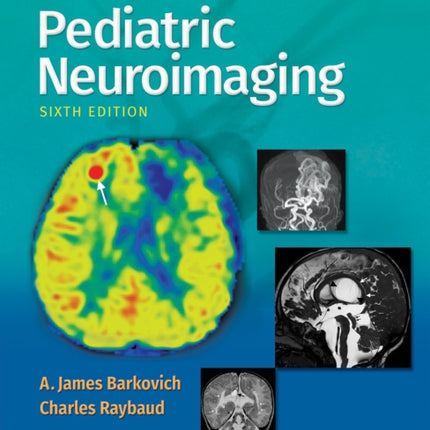 Pediatric Neuroimaging