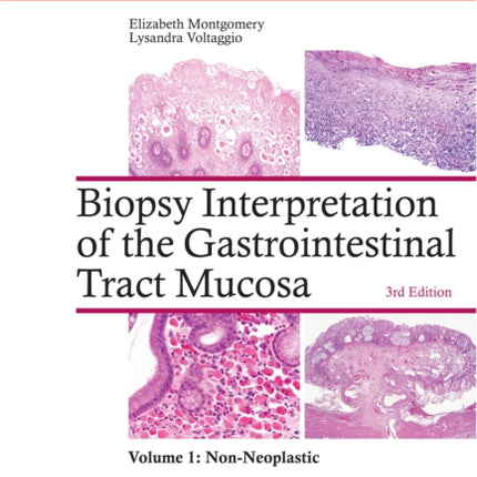 Biopsy Interpretation of the Gastrointestinal Tract Mucosa: Volume 1: Non-Neoplastic