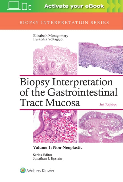 Biopsy Interpretation of the Gastrointestinal Tract Mucosa: Volume 1: Non-Neoplastic