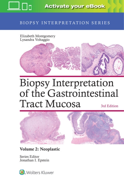 Biopsy Interpretation of the Gastrointestinal Tract Mucosa: Volume 2: Neoplastic