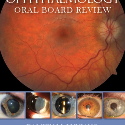 Ophthalmology Oral Board Review