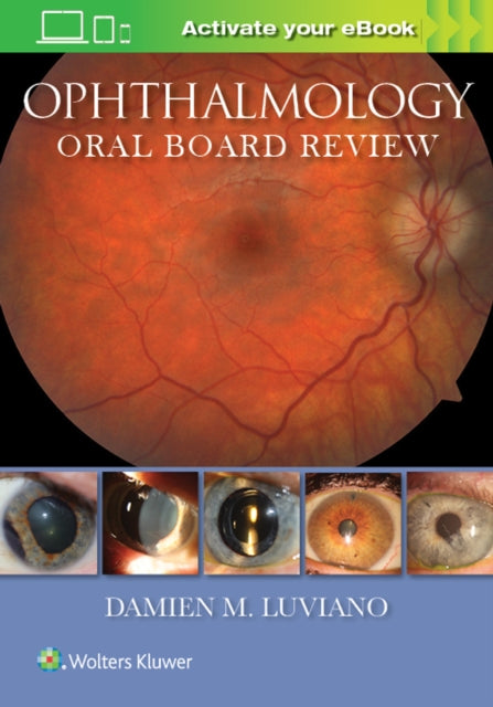 Ophthalmology Oral Board Review