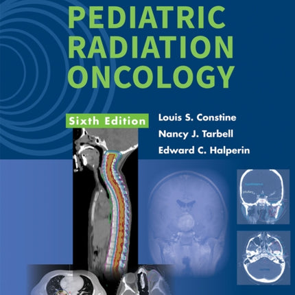 Pediatric Radiation Oncology