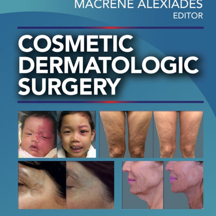 Cosmetic Dermatologic Surgery