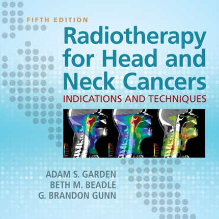 Radiotherapy for Head and Neck Cancers: Indications and Techniques