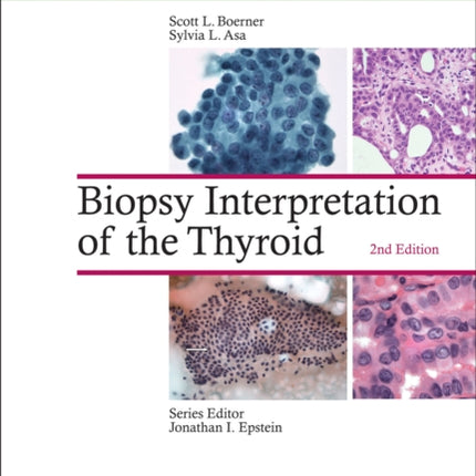 Biopsy Interpretation of the Thyroid