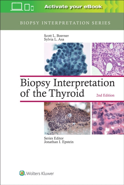 Biopsy Interpretation of the Thyroid