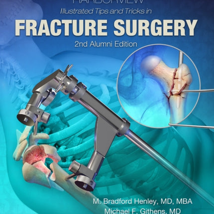 Harborview Illustrated Tips and Tricks in Fracture Surgery