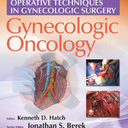 Operative Techniques in Gynecologic Surgery: Gynecologic Oncology