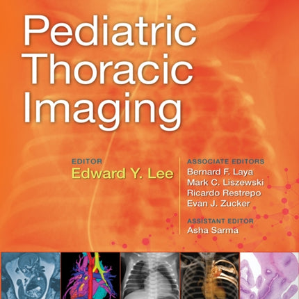 Pediatric Thoracic Imaging