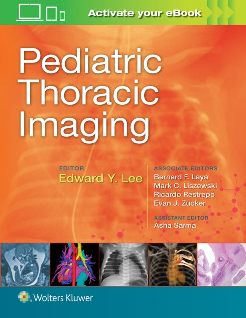 Pediatric Thoracic Imaging