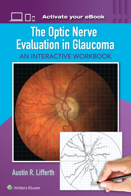 The Optic Nerve Evaluation in Glaucoma: An Interactive Workbook