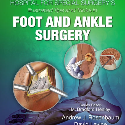 Hospital for Special Surgery's Illustrated Tips and Tricks in Foot and Ankle Surgery