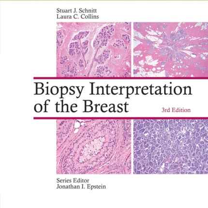 Biopsy Interpretation of the Breast