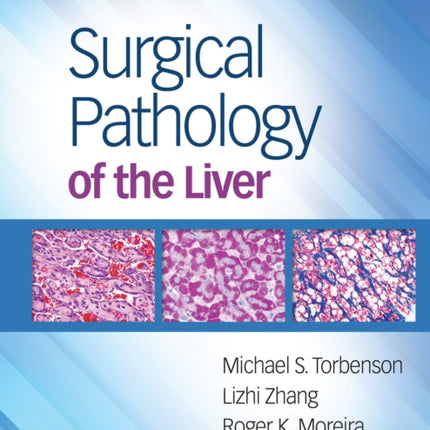 Surgical Pathology of the Liver