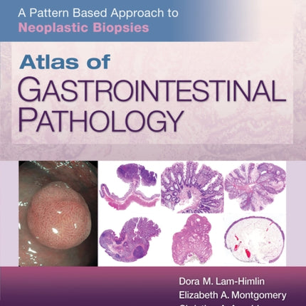 Atlas of Gastrointestinal Pathology: A Pattern Based Approach to Neoplastic Biopsies