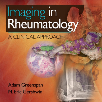 Imaging in Rheumatology: A Clinical Approach