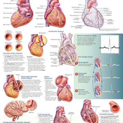 Cardiovascular Disease Anatomical Chart
