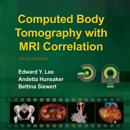 Computed Body Tomography with MRI Correlation