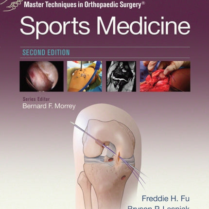 Master Techniques in Orthopaedic Surgery: Sports Medicine