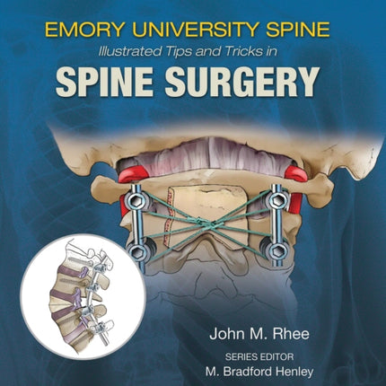 Emory's Illustrated Tips and Tricks in Spine Surgery