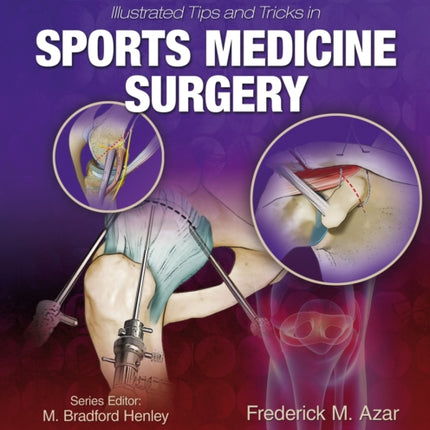 Illustrated Tips and Tricks in Sports Medicine Surgery