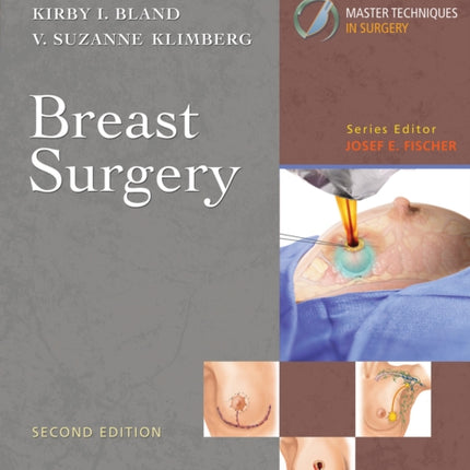 Master Techniques in Surgery: Breast Surgery