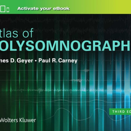 Atlas of Polysomnography