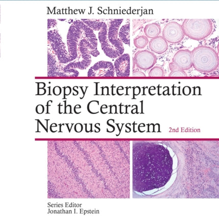 Biopsy Interpretation of the Central Nervous System