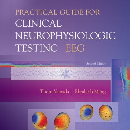 Practical Guide for Clinical Neurophysiologic Testing: EEG