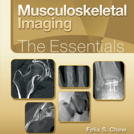 Musculoskeletal Imaging: The Essentials